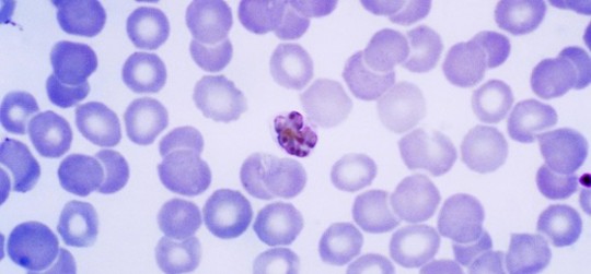 Plasmodium malariae